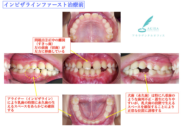 症例紹介