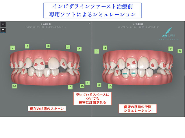 症例紹介