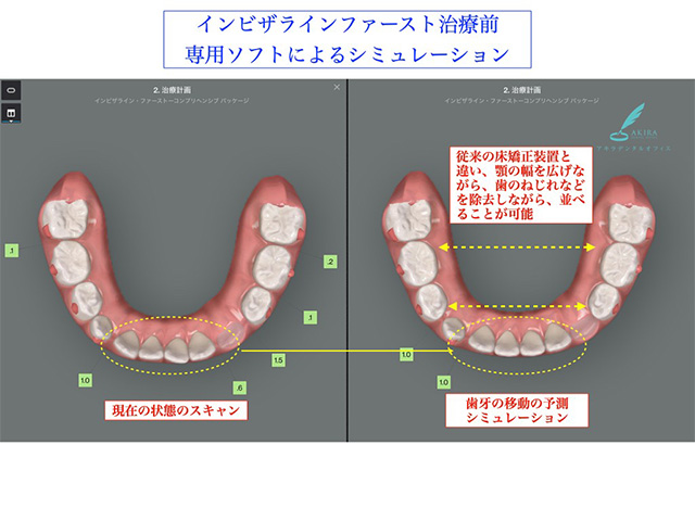 症例紹介