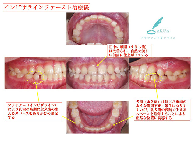 症例紹介