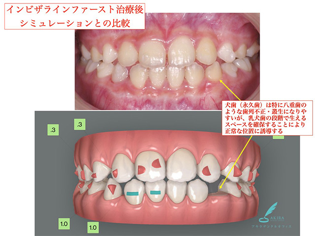 症例紹介